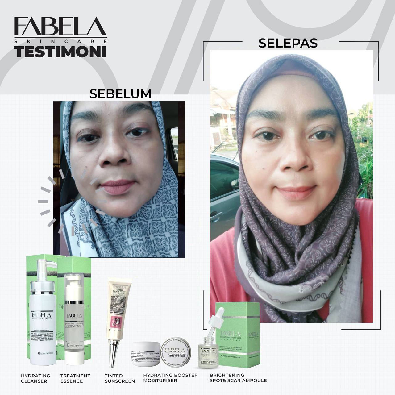 fabelaskincare-feedback-set2